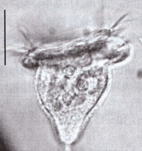 pseudovorticella pattersoni