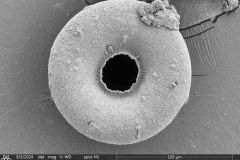 <em>Arcella crenulata</em>