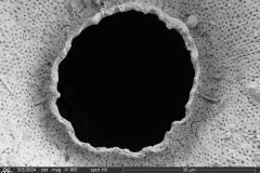 Arcella-crenulata_001