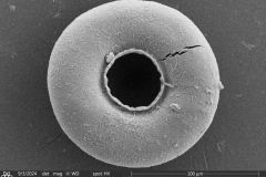 Arcella-crenulata_003