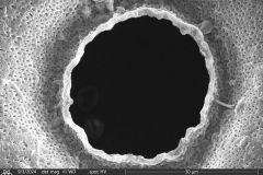 Arcella-crenulata_003b