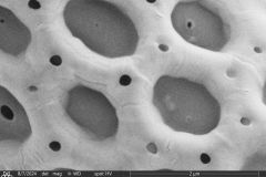 Arcella-leidyana-4