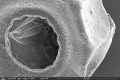 Arcella-leidyana-5