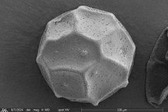 Arcella-leidyana-9