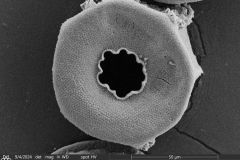 <em>Arcella prismatica</em>