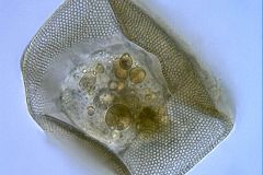 Arcella-prismatica-from-mer-bleue-profile