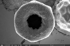 arcella-prismatica
