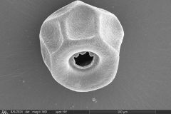 <em>Arcella spectabilis</em> -- large morphotype