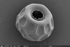 <em>Arcella spectabilis</em> -- small morphotype