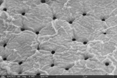 small-arcella-spectabilis-morphotype_013