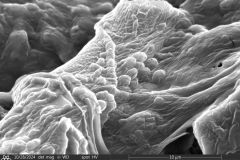 Cyclopyxis-pirini-1c