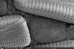 Cylindrifflugia-bacillariarum-2