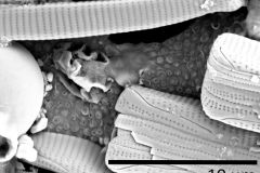 Cylindrifflugia-bacillariarum-3-cropped