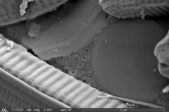 Cylindrifflugia-bacillariarum-5