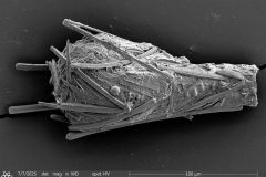 <em>Difflugia bacillifera</em>