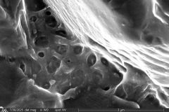 Difflugia-distenda-2