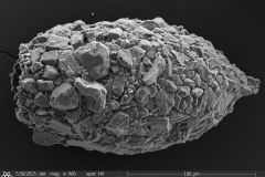 Difflugia-distenda-3