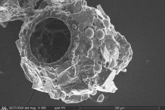 <em>Difflugia globulosa</em>