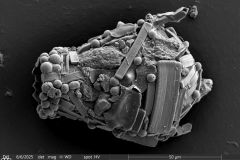 <em>Difflugia leidyi</em>