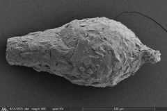 <em>Difflugia microclaviformis</em>