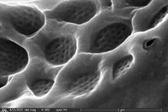 Difflugia-microclaviformis-organic-cement-30-resized