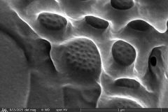 Difflugia-microclaviformis-resized-2