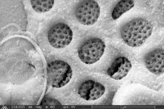 difflugia-microclaviformis-cement-2-resized