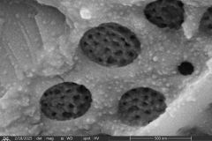 difflugia-microclaviformis-cement-7-resized