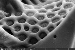 difflugia-microclaviformis-cement-resized