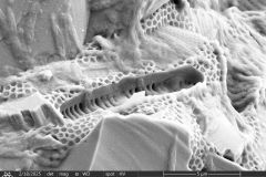 difflugia-microclaviformis_001-resized