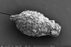 <em>Difflugia</em> cf.  <em>claviformis</em>