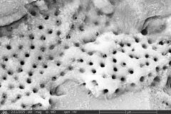 difflugia-claviformis-etd