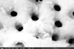 difflugia-claviformis-etd_001