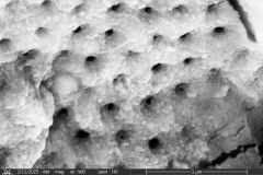 difflugia-claviformis-etd_002