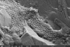 difflugia-claviformis-etd_006