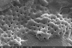 difflugia-claviformis-t1