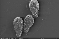 Difflugia-pyriformis-1