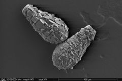 Difflugia-pyriformis-5