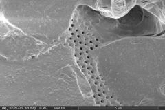 Difflugia-pyriformis-7