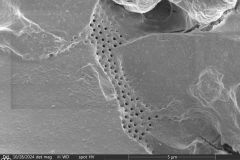 Difflugia-pyriformis-8