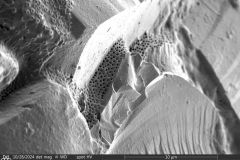 Difflugia-pyriformis-9