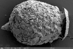 <em>Difflugia urceolata</em> var. <em>olla</em>