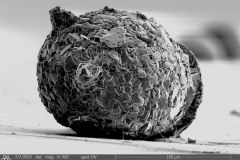 Difflugia-urceolata-olla-2