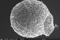 Lesquereusia-gibbosa-1