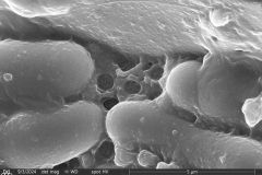 Lesquereusia-gibbosa-6