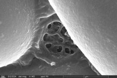 Lesquereusia-gibbosa_001