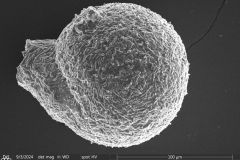 Lesquereusia-gibbosa_013