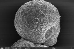 Lesquereusia-gibbosa_018