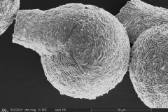 <em>Lesquereusia spiralis</em>