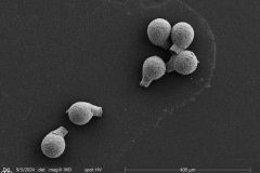 Lesquereusia-spiralis-0